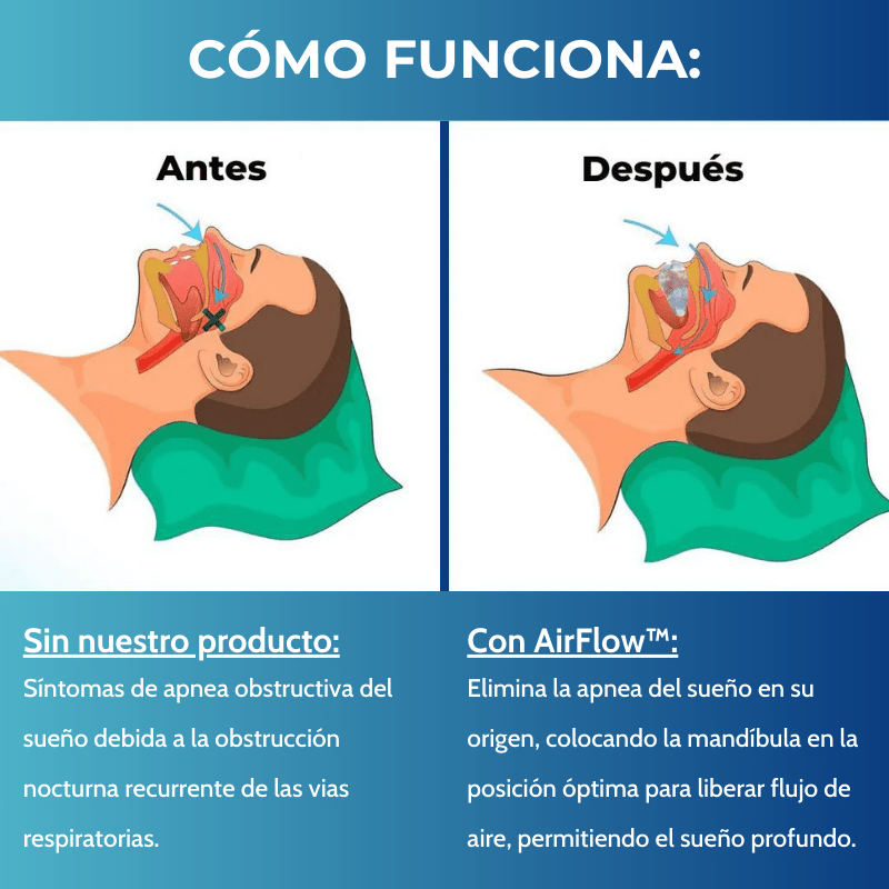 AirFlow™ - ¡No vuelvas a roncar!